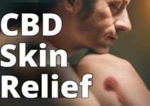 The Ultimate Guide To Using Cannabidiol For Psoriasis Relief