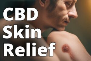 The Ultimate Guide To Using Cannabidiol For Psoriasis Relief